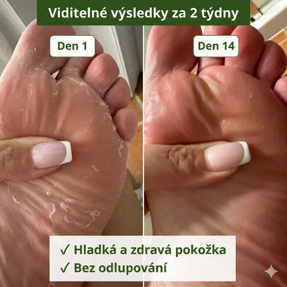 Antimykotické mýdlo Nuveah